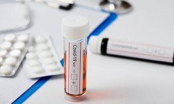 Кыргызстанда коронавирус дагы 250 адамдан табылды