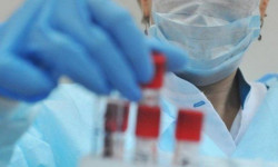 Эпидемиологиялык кырдаал оор