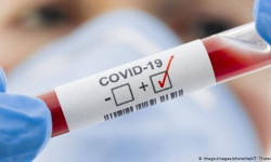 Кыргызстанда COVID-19 вирусун жуктуруу жалпысынан 5 017 учурга жетти