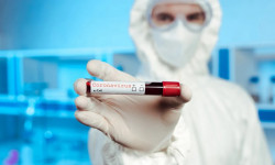 Казакстанда бир суткада COVID-19 жуктурган 71 жаңы учур катталды
