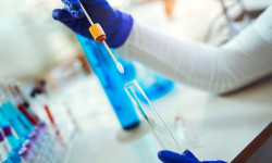 Өткөн суткада коронавирус 362 кишиден табылып, 275 бейтап айыкты