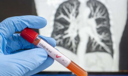 Коронавирустан соңку суткада 7 адам каза болду