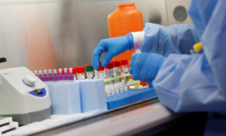 Жасалма ПЧР-тест саткандар кармалды