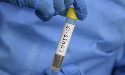 Акыркы бир суткада 494 адамдан коронавирус илдети аныкталып, 5 киши каза болду 
