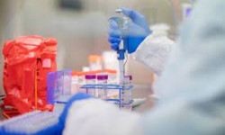 Бир сутка ичинде COVID-19 илдети 822 адамдан аныкталды