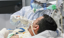 Бүгүнкү күнгө карата COVID-19 менен ооруган 132 бейтаптын абалы оор - Статистика 