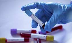 Коронавирустан жабыркагандар күн санап көбөйүүдө