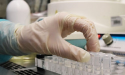 Өлкөдө сутка ичинде коронавирустан дагы 10 бейтап каза болду