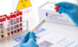 COVID-19: Өткөн суткада 10 киши каза болуп, 1 291 киши оору жуктуруп алган