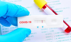 COVID-19: Кыргызстанда 22-июлга карата дагы 1 169 адамдан аныкталды