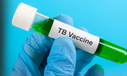 Өткөн жылга салыштырмалуу кургак учукка чалдыккандар көбөйүүдө