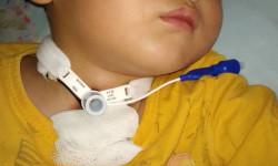 Алты жашар Болоттун операциясына тез арада каражат керек. Кайдыгер болбой жардамга кол суналы