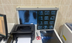 Мамлекеттик медициналык мекемеге компьютердик томографиядан өткөрүүчү заманбап аппарат алынды