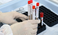 COVID-19: Казакстанда 7 573 жаңы учур катталды 