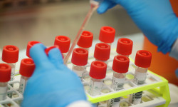 Кыргызстанда 5-августка карата коронавирус дагы 840 адамдан аныкталды