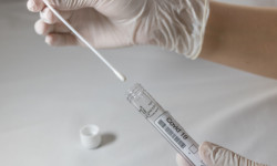 COVID-19: 8-августка карата дагы 602 адамдан аныкталды