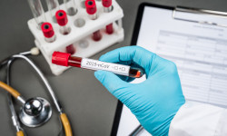 COVID-19: Акыркы суткада дагы 520 адамдан аныкталып, 6 бейтап каза болду