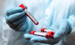 Кыргызстанда бир суткада 228 адамдан COVID-19 жаңы табылып, 5 адам каза болду