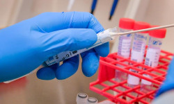 Жылдыз Бакашова ПЧР-анализдин жыйынтыктарын бурмалоо фактыларын жеке көзөмөлүнө алды