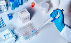 Өлкөдө коронавирус дагы 152 адамдан аныкталды, 6 киши каза болду