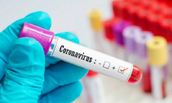 Кыргызстанда 1-сентябрга карата коронавирус дагы 142 адамдан аныкталды