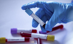 Коронавирус акыркы суткада 95 адамдан аныкталып, 3 бейтап каза болду 