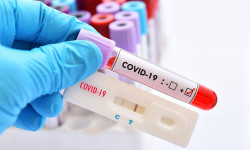 Коронавирус: Кыргызстанда 25-сентябрга карата 79 жаңы учуру катталды