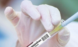 АКШ пандемияга байланыштуу Казакстанга $2,4 миллион бөлөт