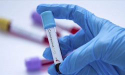 Кыргызстанда 26-октябрга карата коронавирус 112 адамдан аныкталды