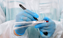 Акыркы суткада 81 адамдан COVID-19 табылып, эки бейтап каза болду