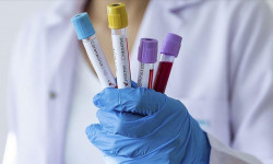 Кыргызстанда 16-ноябрга карата коронавирус 103 адамдан аныкталды