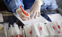 COVID-19: Кыргызстанда бир суткада 3 бейтап каза болуп, 53 учур жаңы аныкталды