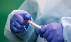 Кыргызстанда 30-ноябрга карата коронавирус дагы 66 адамдан аныкталды