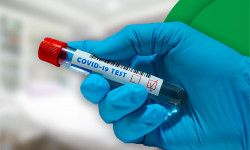 Кыргызстанда 4-декабрга карата коронавирус 63 адамдан аныкталды