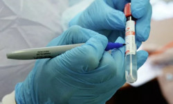 COVID-19: Бүгүнкү күнгө карата өлкөдөгү эпидемиологиялык абал