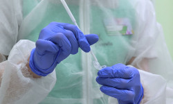 Соңку бир суткада Кыргызстандын аймагында дагы 152 адамдан коронавирус аныкталды