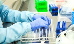 Кыргызстанда акыркы суткада 193 адамдан COVID-19 табылып, эки бейтап каза болду