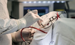 Ошто жүрөккө өзгөчө операция жасалды 