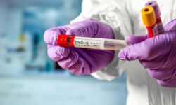 Кыргызсанда коронавирус 205 адамдан аныкталып, 4 бейтап каза болду