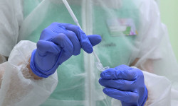 Кыргызстанда 8-мартка карата коронавирус 17 адамдан аныкталды