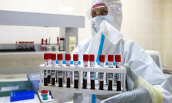 "Дельта" жана "омикрондун" мутациясын айкалыштырган коронавирустун гибрид түрү аныкталды