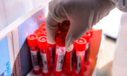 COVID-19: Кыргызстанда жаңы 3 учур катталып, бир жаран оорудан айыкты