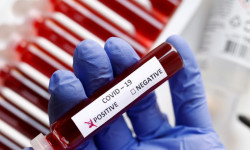 Өлкөдө 19-апрелге карата коронавирус 2 адамдан аныкталды