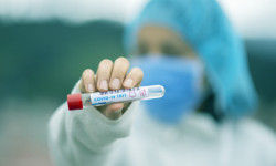 Кыргызстанда 21-апрелге карата коронавирустун бир жаңы учуру катталды