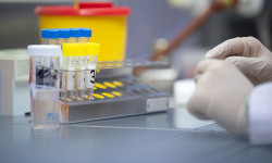 Кыргызстанда 26-сентябрдан 2-октябрга чейин COVID-19дун 77 жаңы учуру аныкталды