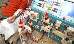 Гемодиализ алгандардын саны  көбөйдү 