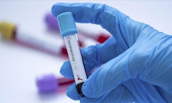 Коронавируска байланыштуу өзгөчө тартип алынды