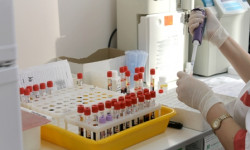 Кыргызстанда февраль айында COVID-19дун 40 жаңы учуру аныкталды