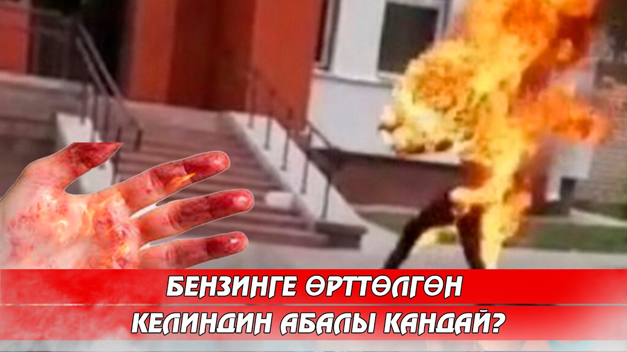 Бензинге өрттөлгөн келиндин абалы кандай?